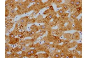 Immunohistochemistry (IHC) image for anti-Cytochrome P450, Family 3, Subfamily A, Polypeptide 4 (CYP3A4) antibody (ABIN7127448)