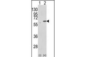 Western blot analysis of PDIA3 (arrow) using rabbit polyclonal PDIA3 Antibody (C-term) (ABIN389464 and ABIN2839529). (PDIA3 Antikörper  (C-Term))