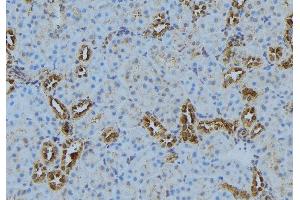 ABIN6272877 at 1/100 staining Mouse kidney tissue by IHC-P. (LPCAT1 Antikörper  (Internal Region))