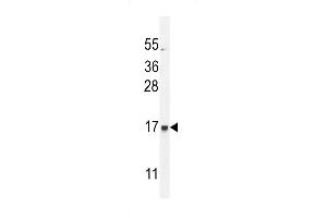 C Antibody (C-term) (ABIN654737 and ABIN2844424) western blot analysis in MDA-M cell line lysates (35 μg/lane). (CFAP410 Antikörper  (C-Term))