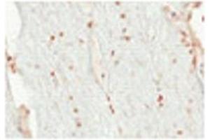 Immunohistochemistry (IHC) image for anti-Oligodendrocyte Lineage Transcription Factor 2 (OLIG2) (N-Term) antibody (ABIN2777314)