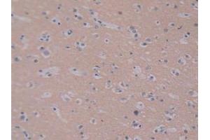 IHC-P analysis of Human Brain Tissue, with DAB staining. (PEBP1 Antikörper  (AA 2-187))