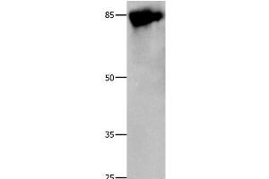 Western Blot analysis of 293T cell using Caldesmon Polyclonal Antibody at dilution of 1:800 (Caldesmon Antikörper)