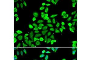 Immunofluorescence analysis of A549 cells using CDC16 Polyclonal Antibody (CDC16 Antikörper)