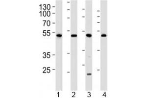 Western blot analysis of lysate from 1) human 293, 2) mouse NIH3T3, 3) rat C6 cell line and 4) mouse kidney tissue lysate using Cdk9 antibody at 1:1000. (CDK9 Antikörper  (AA 251-278))