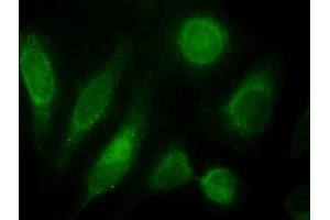 Immunofluorescence testing of HeLa cells with ODZ3 antibody at 10ug/ml [green] shows staining of nuclei. (TENM3 Antikörper)