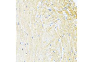 Immunohistochemistry of paraffin-embedded mouse heart using UQCC2 antibody  at dilution of 1:100 (40x lens). (MNF1 Antikörper  (AA 14-126))