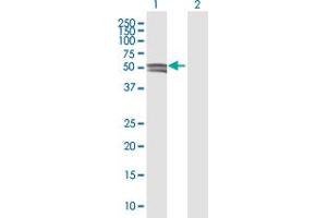 Western Blotting (WB) image for anti-Glucosaminyl (N-Acetyl) Transferase 1, Core 2 (GCNT1) (AA 1-428) antibody (ABIN515997)