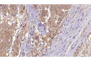 Immunohistochemistry (IHC) image for anti-Collagen, Type IV, alpha 1 (COL4A1) antibody (ABIN6260943)