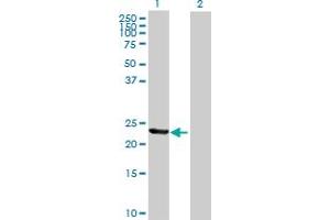 Western Blot analysis of TIA1 expression in transfected 293T cell line by TIA1 MaxPab polyclonal antibody. (TIA1 Antikörper  (AA 1-214))