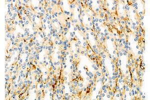 ABIN6264916 and ABIN6273158 at 1/100 staining Mouse kidney tissue by IHC-P.
