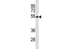 Ips-1 antibody western blot analysis in mouse spleen tissue lysate. (MAVS Antikörper  (AA 1-30))