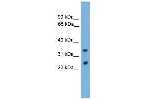 CHMP4B antibody used at 0. (CHMP4B Antikörper  (Middle Region))