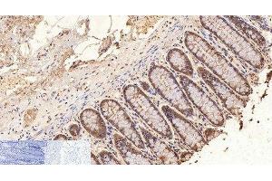 Immunohistochemistry of paraffin-embedded Human colon tissue using GAPDH Monoclonal Antibody at dilution of 1:200. (GAPDH Antikörper)