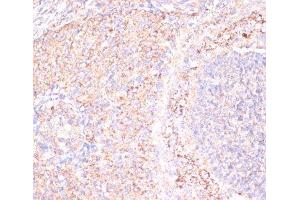 Immunohistochemistry of paraffin-embedded Rat ovary using ATP5A1 Polyclonal Antibody at dilution of 1:100 (40x lens). (ATP5A1 Antikörper)