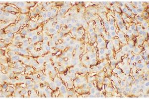 Immunohistochemistry of paraffin-embedded Mouse liver using FGB Polycloanl Antibody at dilution of 1:200 (Fibrinogen beta Chain Antikörper)