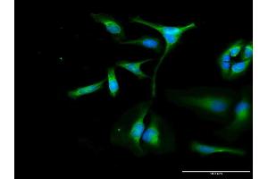 Immunofluorescence of purified MaxPab antibody to OXA1L on HeLa cell. (OXA1L Antikörper  (AA 1-435))