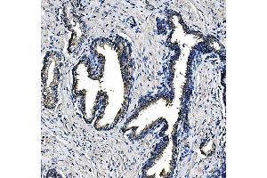 IHC analysis of PCK2 using anti-PCK2 antibody (ABIN7599509). (PEPCK Antikörper  (AA 1-640))
