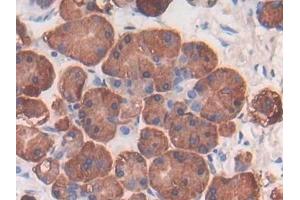 Immunohistochemistry (IHC) image for anti-Fibroblast Growth Factor Receptor-Like 1 (FGFRL1) (AA 168-378) antibody (ABIN7430033)