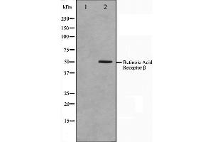 Western blot analysis on HepG2 cell lysate using Retinoic Acid Receptor beta Antibody,The lane on the left is treated with the antigen-specific peptide. (Retinoic Acid Receptor beta Antikörper  (Internal Region))