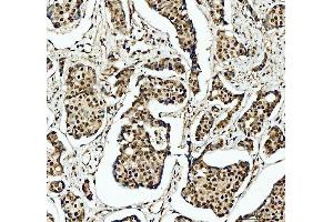 IHC analysis of SFPQ using anti-SFPQ antibody (ABIN7603089). (SFPQ Antikörper  (Middle Region))