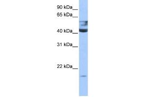 QTRT1 antibody used at 0. (QTRT1 Antikörper)