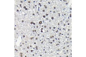 Immunohistochemistry (IHC) image for anti-Mitogen-Activated Protein Kinase 1/3 (MAPK1/3) (pThr185), (pThr202) antibody (ABIN7268610)