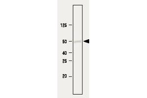 Immunoblot analysis. (SETD7 Antikörper)