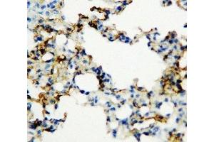 IHC-P: RAGE antibody testing of rat lung tissue (RAGE Antikörper  (Middle Region))