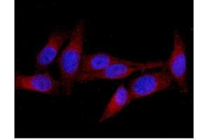 IF analysis of MID1 using anti-MID1 antibody (ABIN6719400). (MID1 Antikörper  (AA 226-278))
