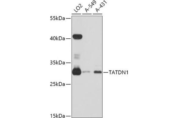 TATDN1 anticorps  (AA 1-297)