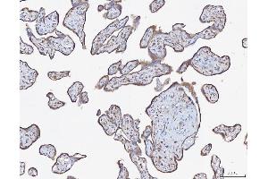 IHC analysis of ATX2/ATXN2 using anti-ATX2/ATXN2 antibody (ABIN3043507). (Ataxin 2 Antikörper  (C-Term))