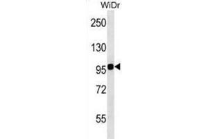 Western Blotting (WB) image for anti-Integrin beta 7 (ITGB7) antibody (ABIN2998522)