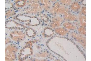 IHC-P analysis of Human Kidney Tissue, with DAB staining. (CACYBP Antikörper  (AA 2-228))