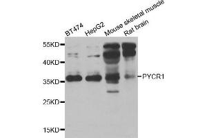 Western blot analysis of extracts of various cell lines, using PYCR1 antibody. (PYCR1 Antikörper)
