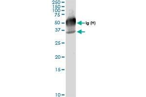 Immunoprecipitation of GALE transfected lysate using anti-GALE MaxPab rabbit polyclonal antibody and Protein A Magnetic Bead , and immunoblotted with GALE MaxPab rabbit polyclonal antibody (D01) . (GALE Antikörper  (AA 1-348))