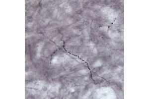Immunohistochemistry (IHC) image for anti-Solute Carrier Family 17 (Vesicular Glutamate Transporter), Member 7 (SLC17A7) antibody (ABIN351379)