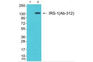 Western Blotting (WB) image for anti-Insulin Receptor Substrate 1 (IRS1) (Ser312) antibody (ABIN1848113) (IRS1 Antikörper  (Ser312))