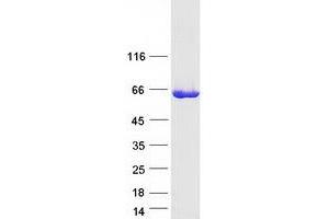 Western Blotting (WB) image for Inositol-3-Phosphate Synthase 1 (ISYNA1) protein (Myc-DYKDDDDK Tag) (ABIN2723876)
