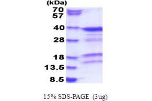SDS-PAGE (SDS) image for Protein Kinase, Interferon-Inducible Double Stranded RNA Dependent Activator (PRKRA) (AA 1-313) protein (His tag) (ABIN5853828) (PRKRA Protein (AA 1-313) (His tag))
