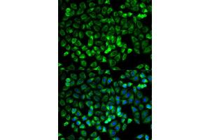 Immunofluorescence (IF) image for anti-Tryptase alpha/beta 1 (TPSAB1) antibody (ABIN1875186) (TPSAB1 Antikörper)
