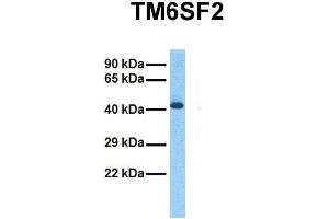 Host:  Rabbit  Target Name:  TM6SF2  Sample Tissue:  Human Fetal Liver  Antibody Dilution:  1.