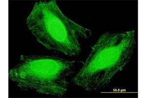 Immunofluorescence of purified MaxPab antibody to ARMC1 on HeLa cell. (ARMC1 Antikörper  (AA 1-282))