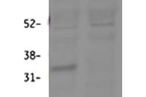 ABIN768641 (0. (HSD11B1 Antikörper  (Internal Region))