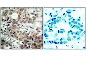 Image no. 1 for anti-Cell Division Cycle 25 Homolog C (S. Pombe) (CDC25C) (pSer216) antibody (ABIN196818) (CDC25C Antikörper  (pSer216))