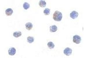 Immunocytochemistry of IKK alpha in Jurkat cells with AP30405PU-N IKK alpha antibody at 10 μg/ml. (IKK alpha Antikörper  (C-Term))