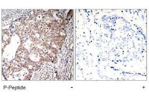Image no. 1 for anti-SHC (Src Homology 2 Domain Containing) Transforming Protein 1 (SHC1) (pTyr427) antibody (ABIN197086) (SHC1 Antikörper  (pTyr427))