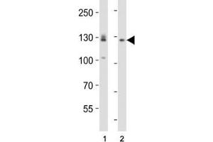 Western blot analysis of lysate from (1) A431 and (2) U-87 MG cell line using EPHA2 antibody diluted at 1:1000. (EPH Receptor A2 Antikörper  (AA 518-552))