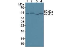 Western blot analysis of (1) Human 293T Cells, (2) Human HeLa cells, (3) Rat Skeletal Muscle Tissue and (4) Human HepG2 Cells. (CS Antikörper  (AA 56-312))