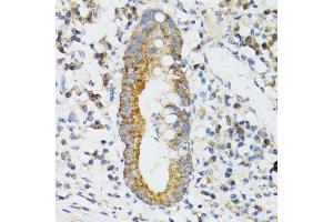 Immunohistochemistry of paraffin-embedded human vermiform appendix using SRP19 antibody (ABIN6129677, ABIN6148450, ABIN6148451 and ABIN6222484) at dilution of 1:100 (40x lens). (SRP19 Antikörper  (AA 1-144))